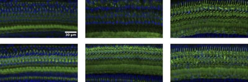 Researchers discuss the design of microneedles for medical treatments