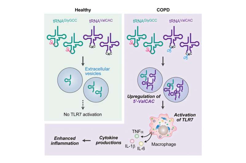 Small RNAs might drive COPD progression: New research lays the foundation for potential new diagnostics and therapies