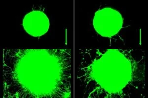 MIT scientists find that motor neuron growth increased significantly over 5 days in response to biochemical (left) and mechanical (right) signals related to exercise. The green ball represents cluster of neurons that grow outward in long tails, or axons.