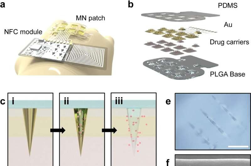 Wireless drug patch shows promise as chronic disease treatment delivery system