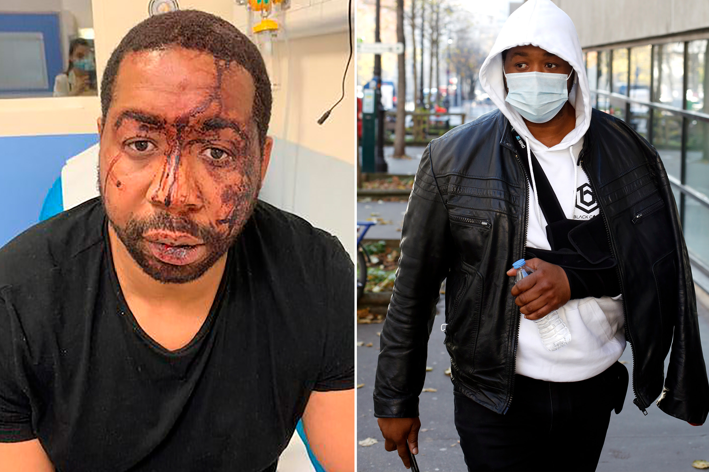 Paris cops suspended over alleged beatdown of black man