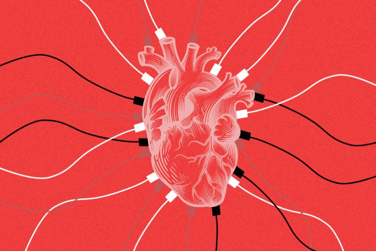 An illustration of a heart with cables attached to it.