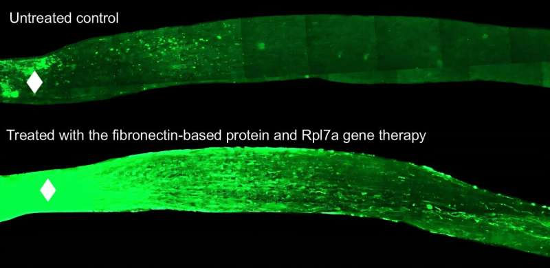 Nerve regrowth findings could lead to a potential treatment for a common cause of blindness