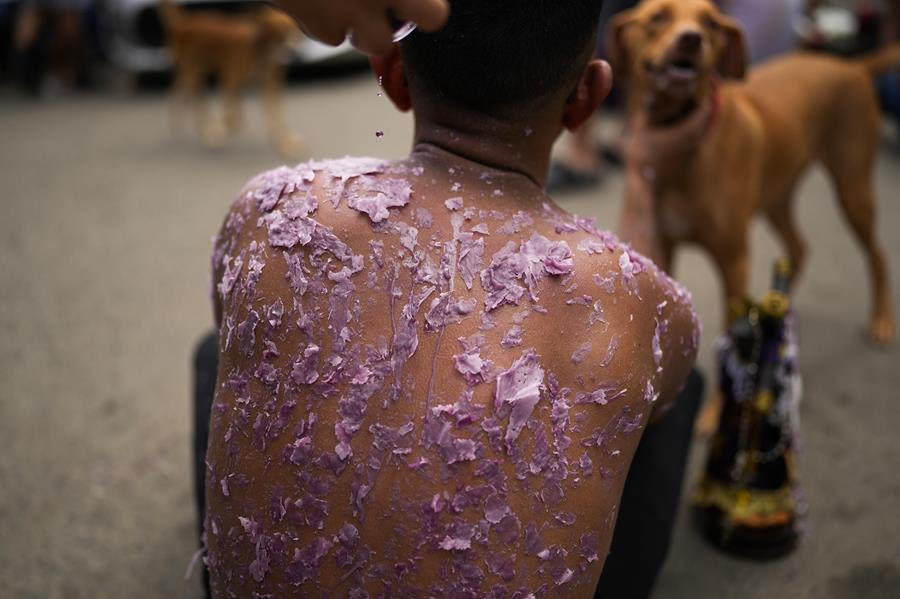 A person with dark skin sits with their back towards the viewer. Their back is covered with pink candle wax.