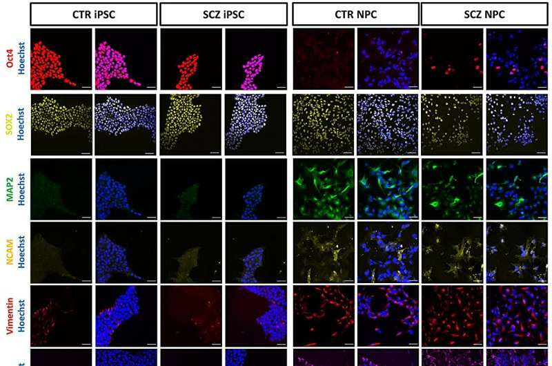 Schizophrenia: NMI observes processes in nerve cells