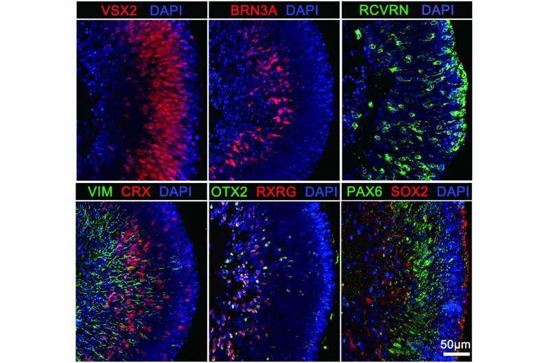 Human retinal stem-like cells discovered with potential to repair vision loss