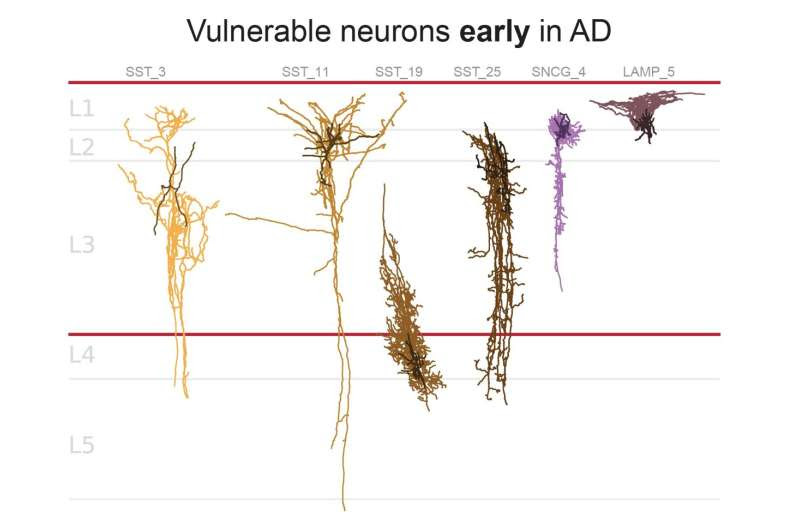 New study traces Alzheimer's 'pathology clock' at unprecedented cellular resolution