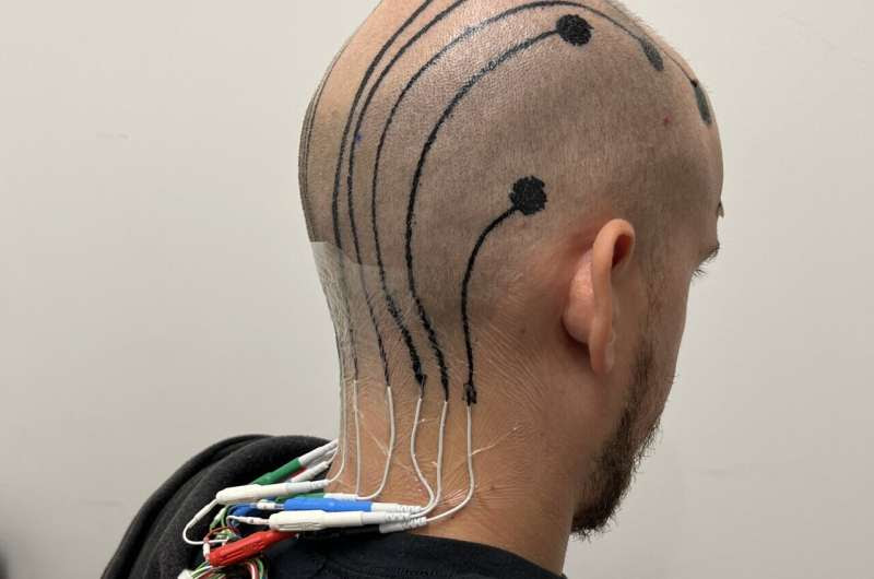 Temporary tattoo printed directly on the scalp offers easy, hair-friendly solution for measuring brainwaves