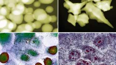 Gold Nanoparticles Interacting With Cancer Cells