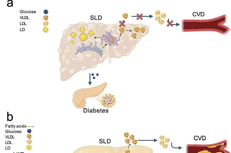 New research reveals two types of fatty liver disease