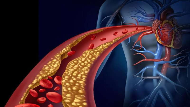 Inflammation can exacerbate risks for cardiovascular disease—and is informing new approaches for treatment