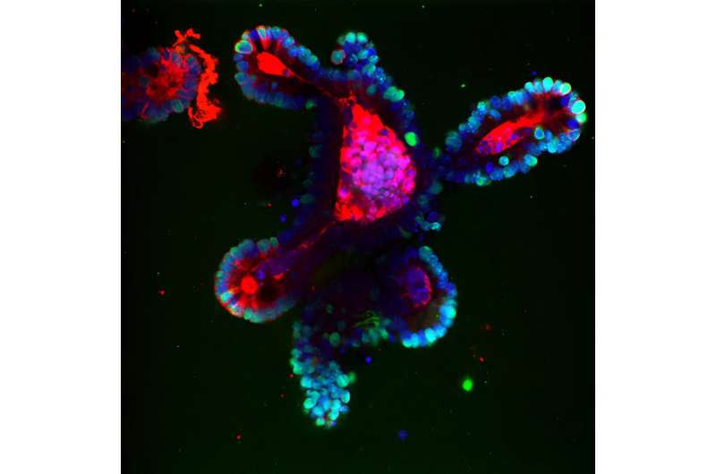 Study identifies promising target for treating inflammatory bowel disease and colitis-induced colorectal cancers