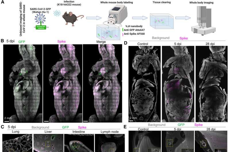 Long COVID: SARS-CoV-2 Spike Protein Accumulation Linked to Long-Lasting Brain Effects