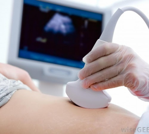 ultrasound-performed-on-pregnant-woman-close-up
