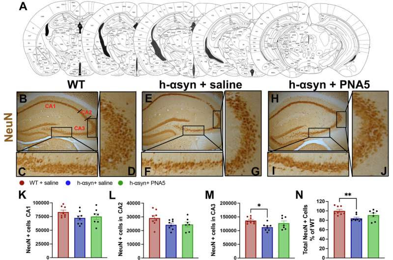 Study identifies tiny protein for potential new drug for Parkinson's-related cognitive decline, dementia