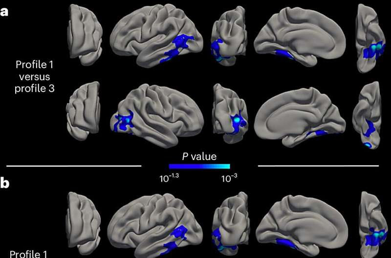 Researchers identify three psychological profiles that could determine the evolution of mental, cognitive and brain health in aging