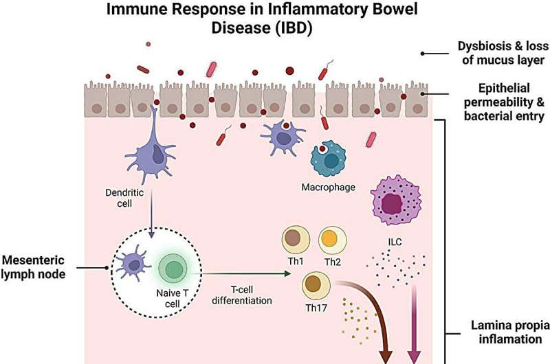 Extracellular vesicles may be key to developing safer and more effective therapies for inflammatory bowel disease