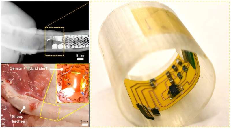 Artificial sensory cilia can monitor internal biomarkers to detect and assess airway diseases