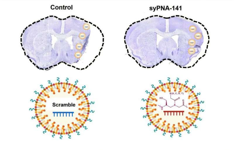 Researchers Working to Extinguish 'Inflammatory Fire' Stroke Causes in the Brain