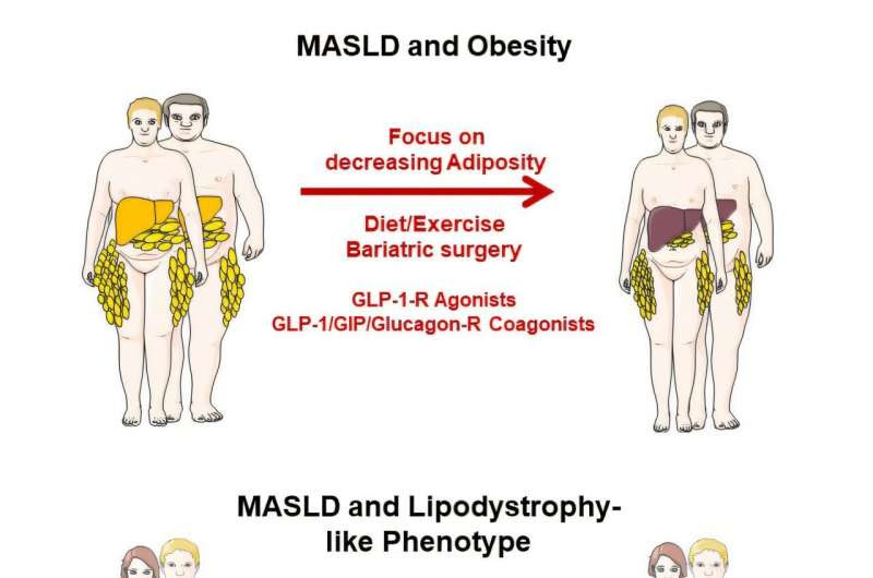 Heterogeneity of metabolic dysfunction-associated steatotic liver disease