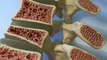 Osteoporosis Anatomy