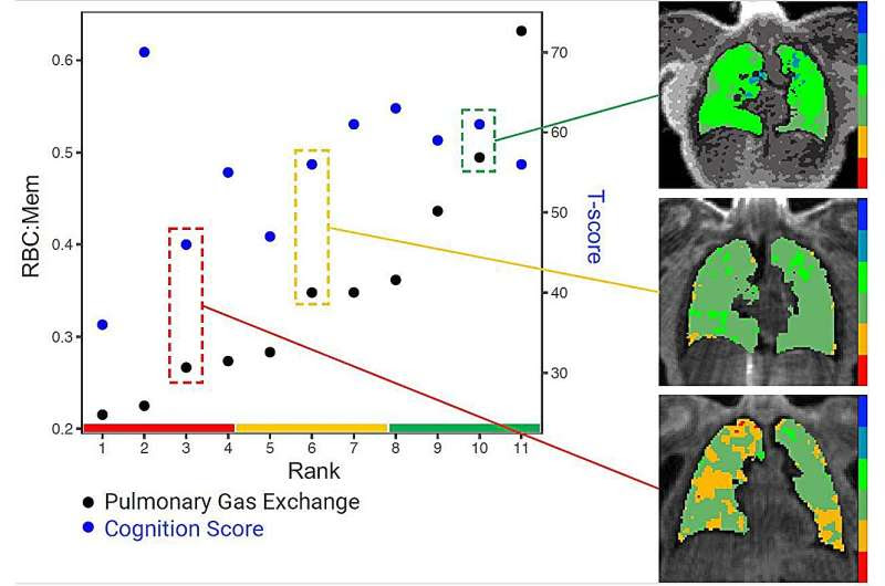 Long COVID brain fog linked to lung function