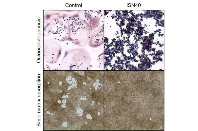 Role of osteogenic CpG oligodeoxynucleotide in osteoporosis