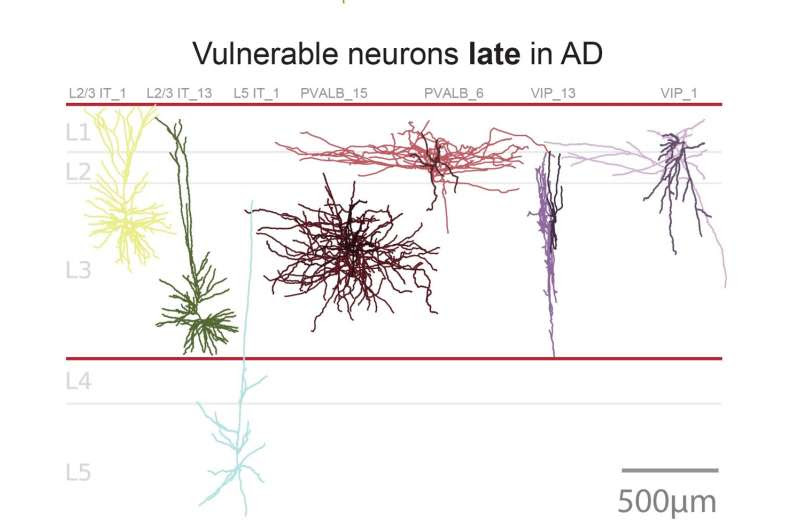 New study traces Alzheimer's 'pathology clock' at unprecedented cellular resolution