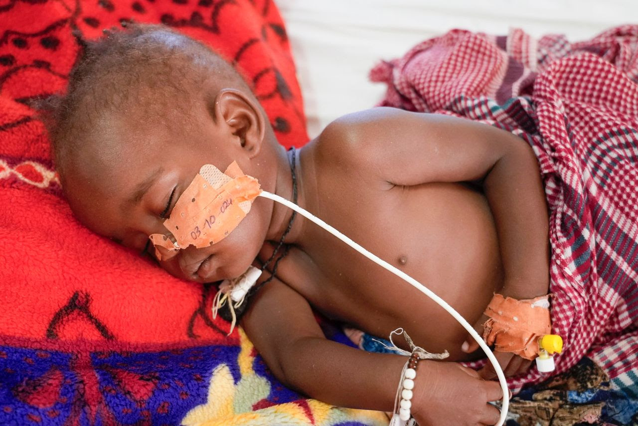 17-month-old Salma IssaAbakar rests in an MSF-run clinic in the Aboutengue displacement site near Acre, Chad, in October. (Sam Mednick/AP)