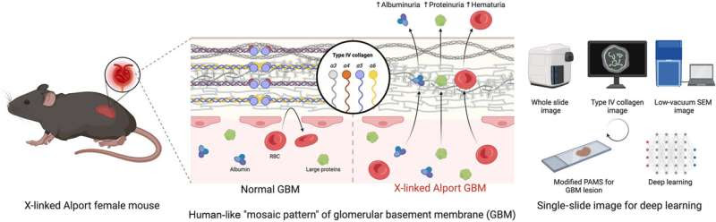 Novel artificial intelligence-based method for pathological diagnosis of hereditary kidney diseases