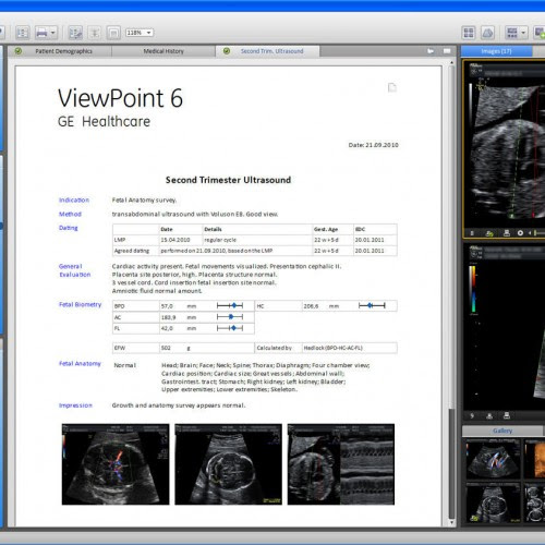 analysis-software-medical-ultrasound-imaging-emr-70717-8086932