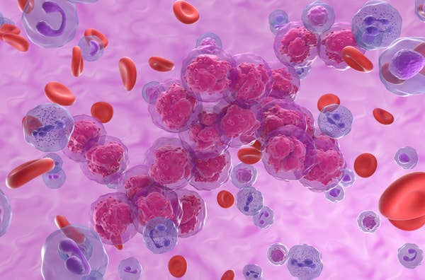 Illustration of various blood cells, including red blood cells and purple cells, representing a scientific concept or medical condition