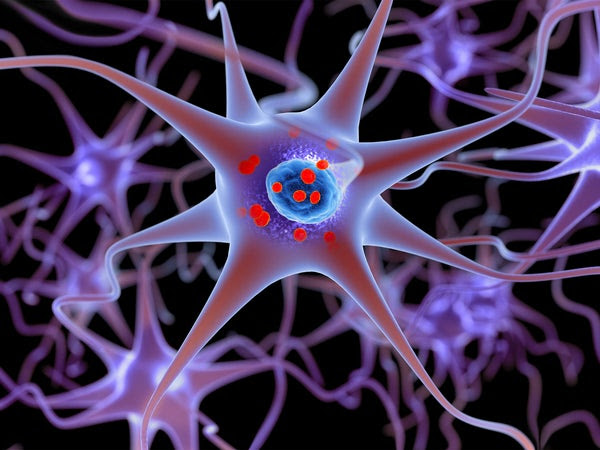 Illustration shows neurons containing deposits of alpha-synuclein (indicated with small red spheres) that have accumulated in the brain cells.