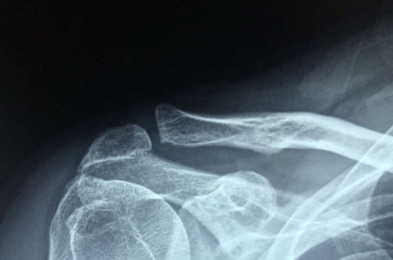 shoulder pain