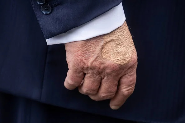 US President Donald Trump's right hand is seen as he speaks to the press before boarding Marine One on the South Lawn of the White House on July 15, 2025, in Washington, DC. Trump is travelling to Pittsburgh, Pennsylvania, to speak at the Pennsylvania Energy and Innovation Summit on the campus of Carnegie Mellon University.