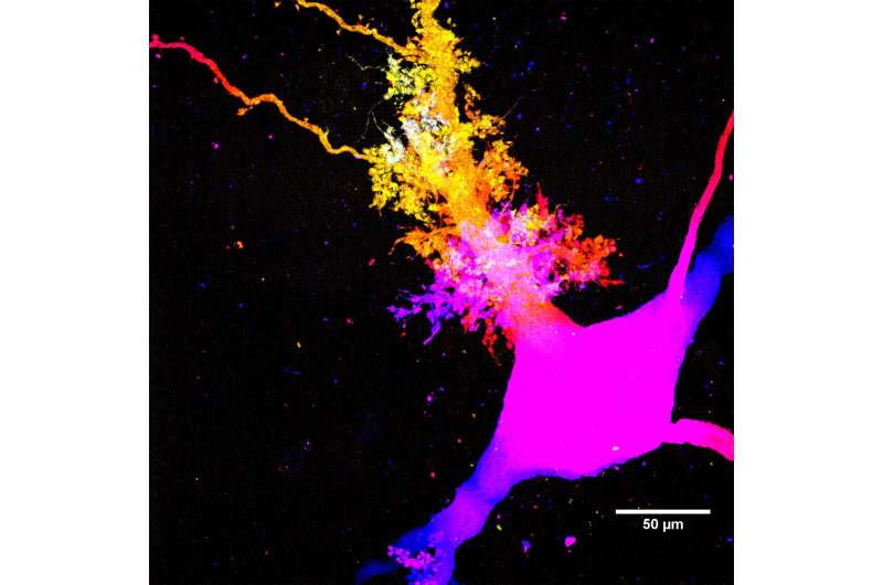 The distinct nerve wiring of human memory