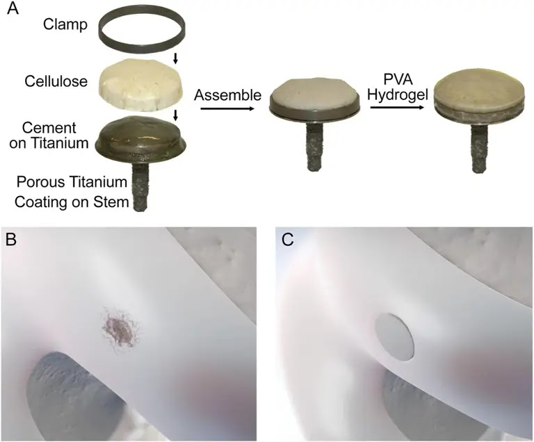 A Synthetic Hydrogel Composite with a Strength and Wear Resistance Greater than Cartilage. (CREDIT: Advanced Functional Materials)