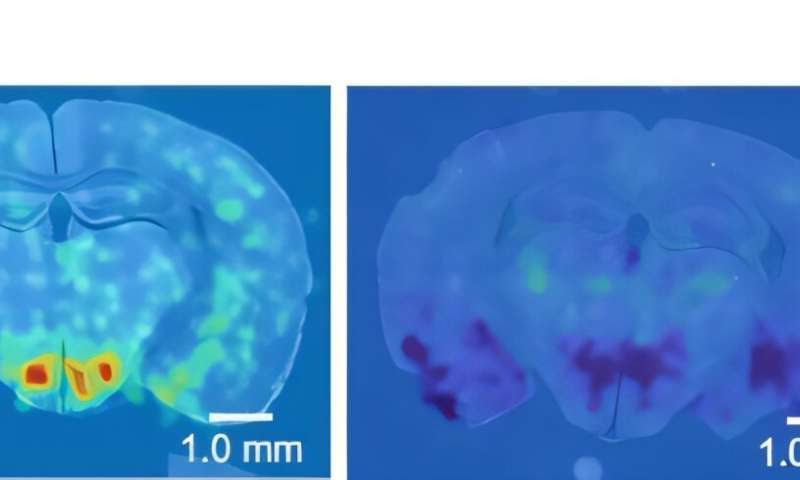 SNU researchers develops micro-shockwave electronic therapy for safe non-invasive treatment of brain disorders