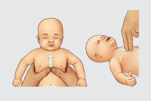 Infant CPR Update