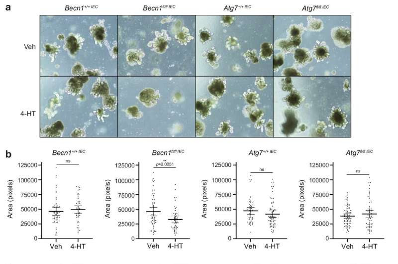 New lead in gut health research