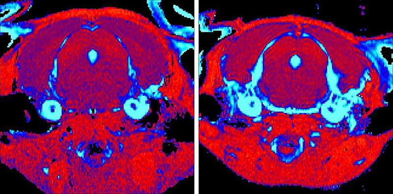 Improving the recipe for gene therapy