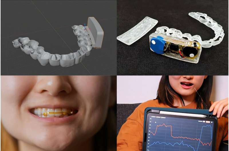 Interactive mouthpiece opens new opportunities for health data, assistive technology, and hands-free interactions | MIT News