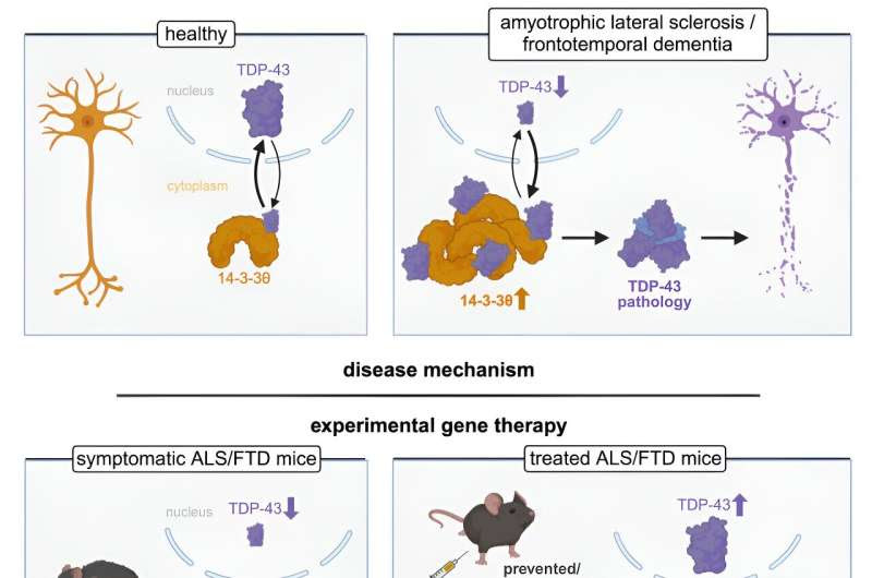 New genetic therapy could be a gamechanger for MND and frontotemporal dementia