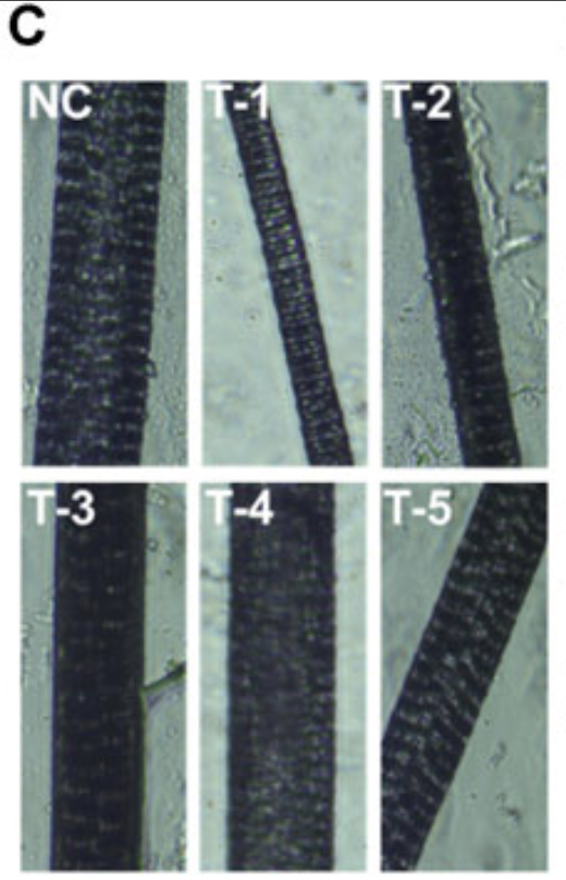 Hair Shaft Thickness