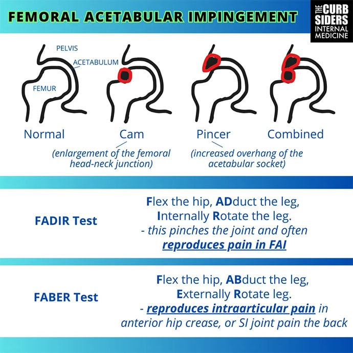 photo of Hip Pain graphic