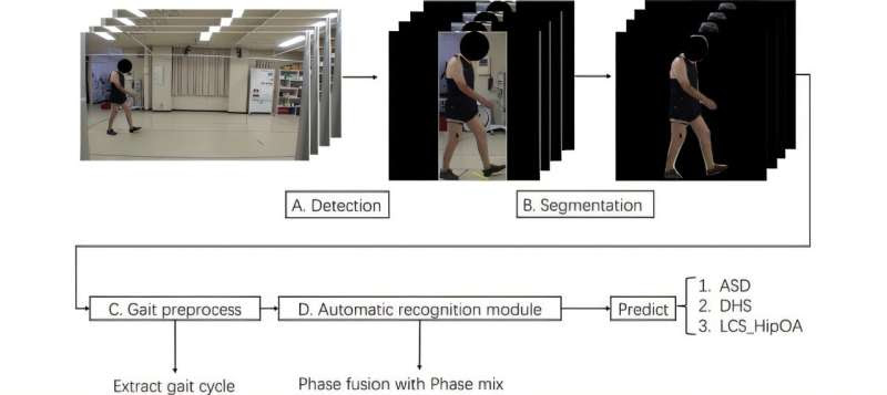 A novel classification method for adult spinal deformity diseases using deep learning of gait data