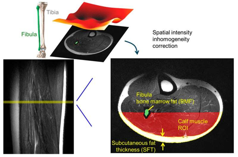 How sex and age shape fat patterns in muscles and bones