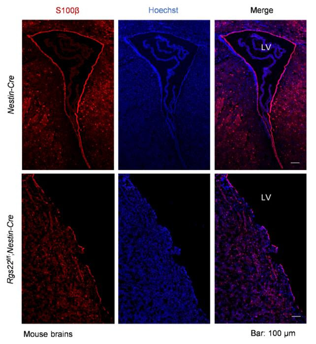 Rgs22-deficiency results in dysfunction of ependymal cells