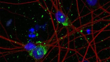 Staining of Human Stem Cell Derived Neurons Shows DNA in Cell Nuclei, Neuron Cytoskeleton, and Tau Aggregates