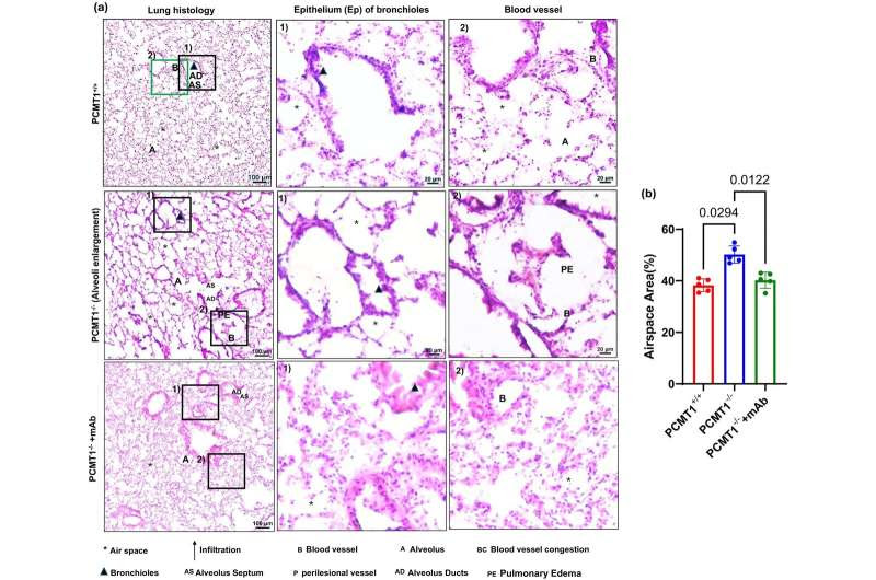 Research discovery may cure age-related lung diseases